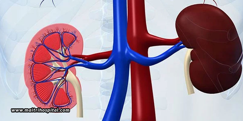 How Does The Kidney Fail And How To Prevent It?